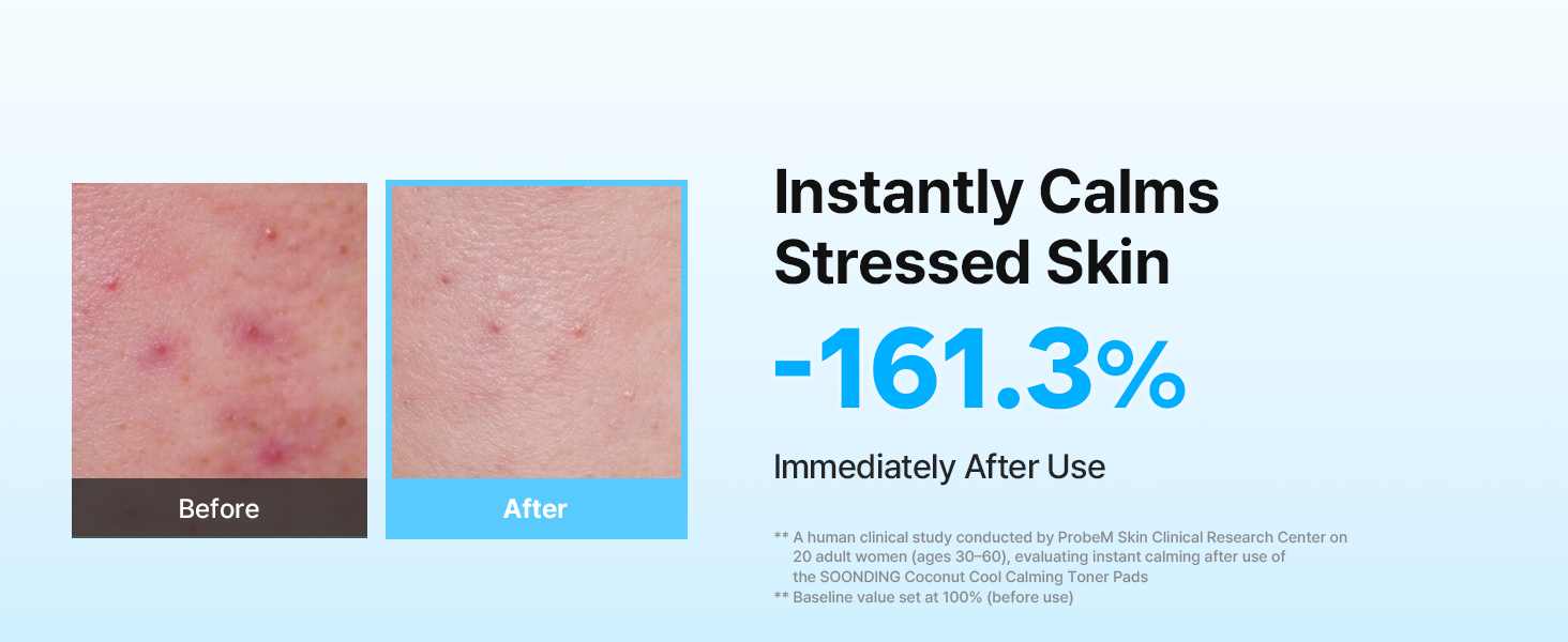 SOONDING Coconut Cool Calming Toner Pads 배너