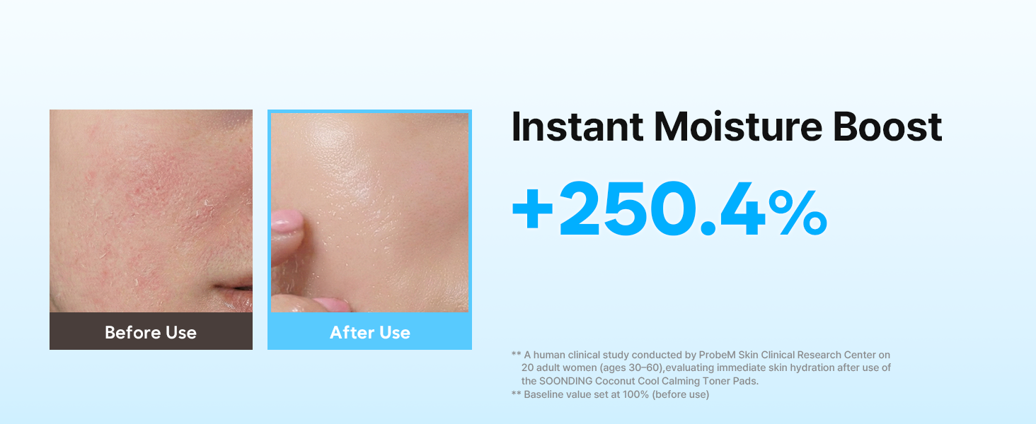 SOONDING Coconut Cool Calming Toner Pads 배너